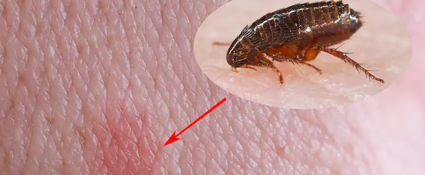 Flea Control for Humans McKinney, TX